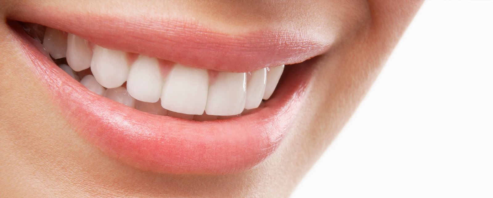Sorriso com dentes alinhados e brancos